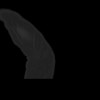 SPORK, NICO - 22.03.1976 - 02.08.2022 - CT obere Extremität - 18:01:46